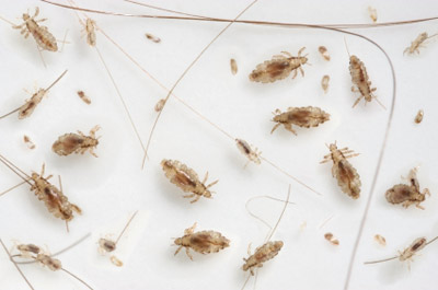 Free Head Lice Diagnosis Free Head Lice Diagnosis